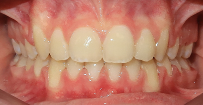 Before & Afters Before & Afters