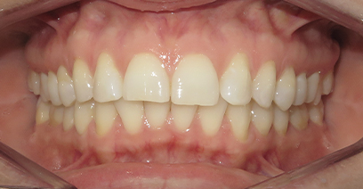 Before & Afters Before & Afters