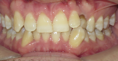Before & Afters Before & Afters