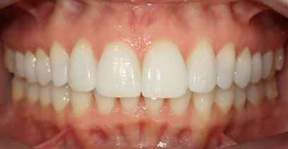 Before & Afters Before & Afters