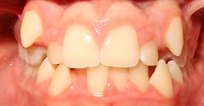 Before & Afters Before & Afters