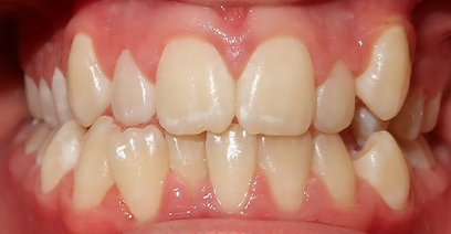 Before & Afters Before & Afters
