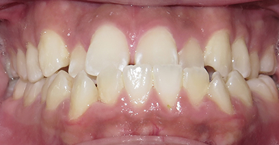 Before & Afters Before & Afters