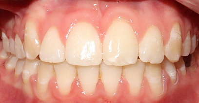 Before & Afters Before & Afters