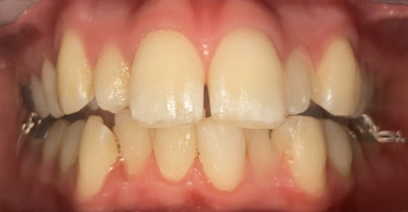 Before & Afters Before & Afters