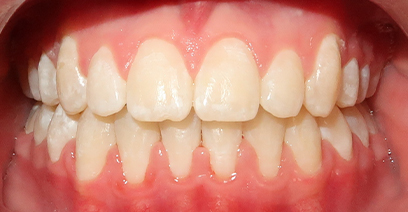 Before & Afters Before & Afters