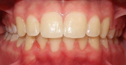 Before & Afters Before & Afters