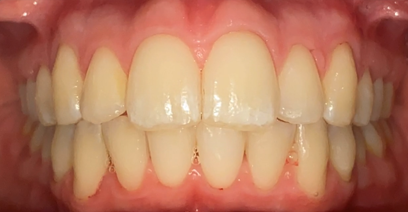 Before & Afters Before & Afters