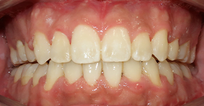 Before & Afters Before & Afters