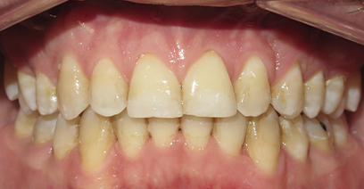 Before & Afters Before & Afters