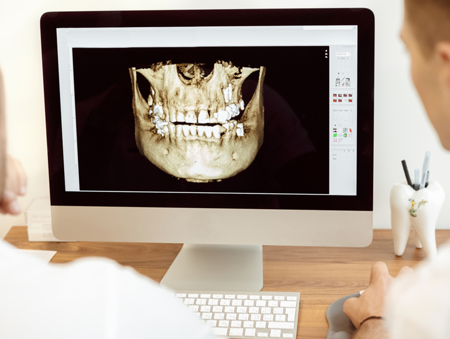 3D orthodontic assessments on screen for development of treatment