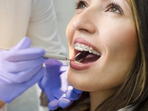 woman with braces at orthodontist knows how long braces stay on for