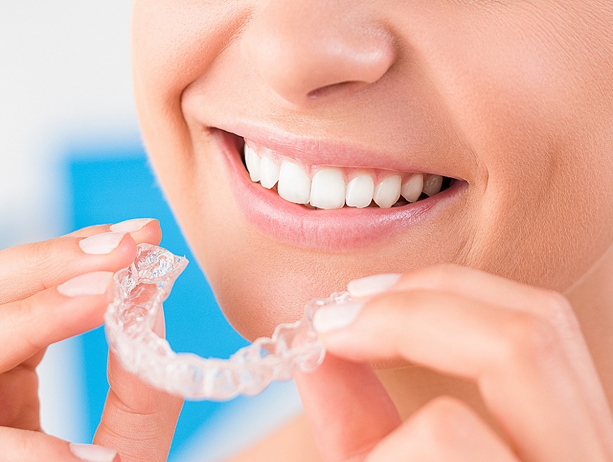 Clear Aligners Currambine