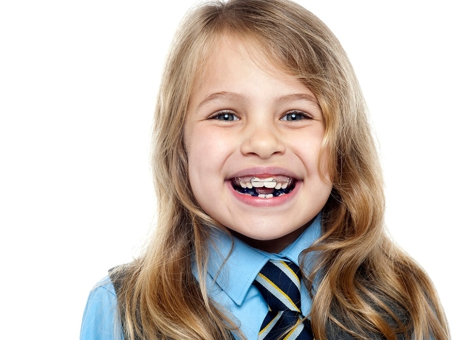 best childrens orthodontist in joondalup