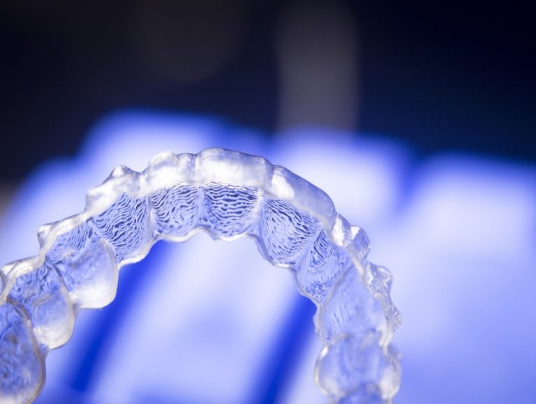 Profile OrthodonticsEverything You Need To Know About Wearing An